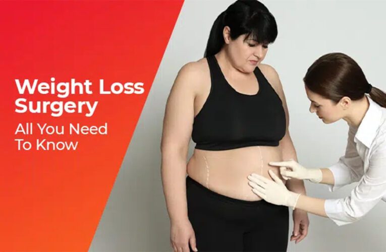 Weight Loss Surgery in USA 2025 | Costs, Types & Risks