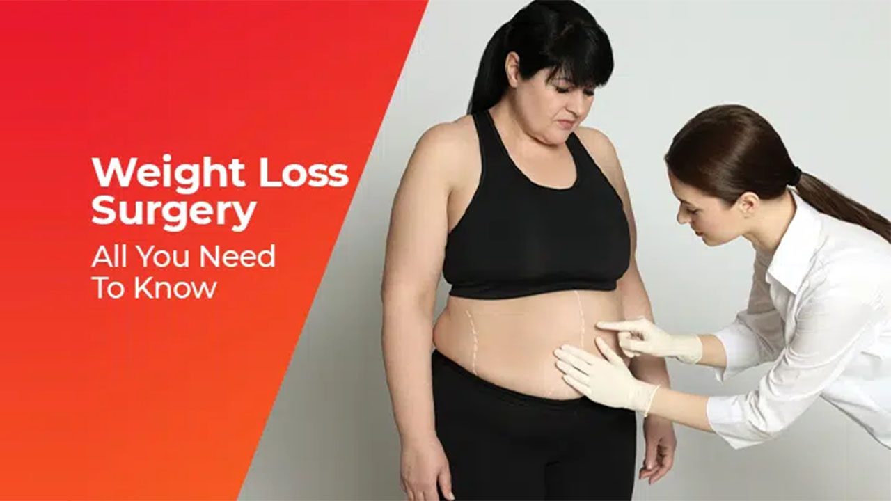 Weight loss Surgery
